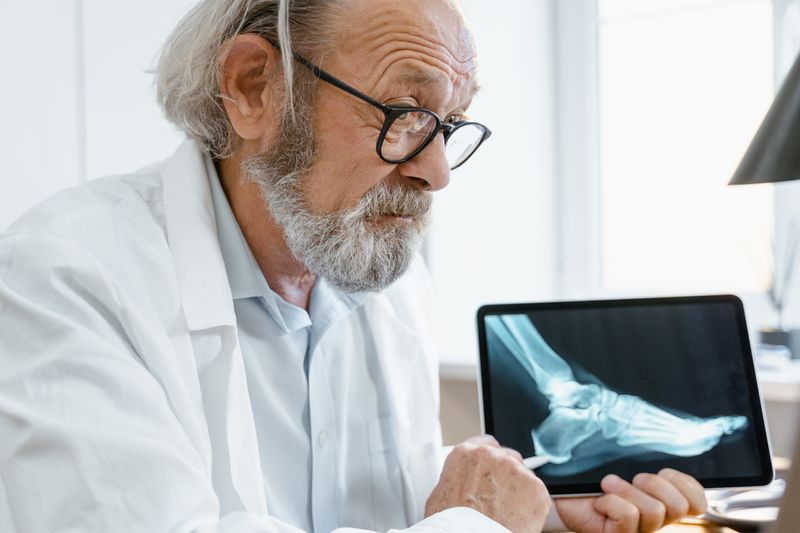 Arthritis: A heavy burden to bear