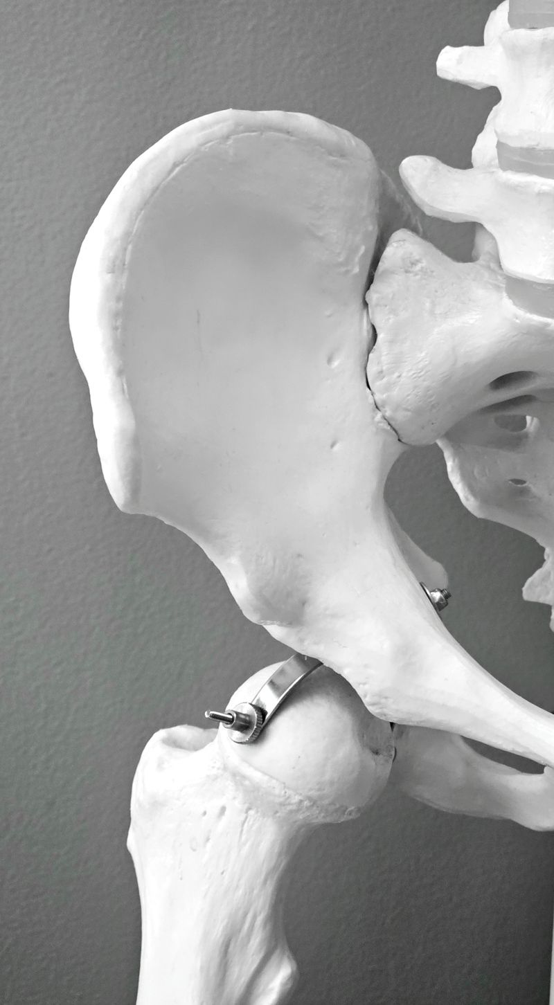 Osteoporosis does not increase coronavirus risk