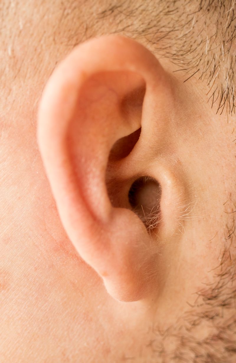 Tinnitus
